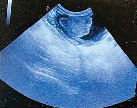 Using ultrasound in the ER setting?