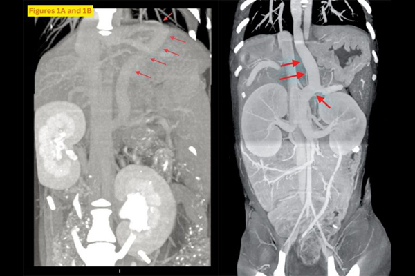 Diagnosing vascular anomalies in puppies