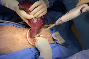 A primer on advanced laparoscopy in small animals