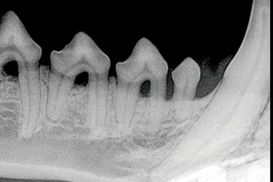 Reviewing the best treatment options for periodontal disease